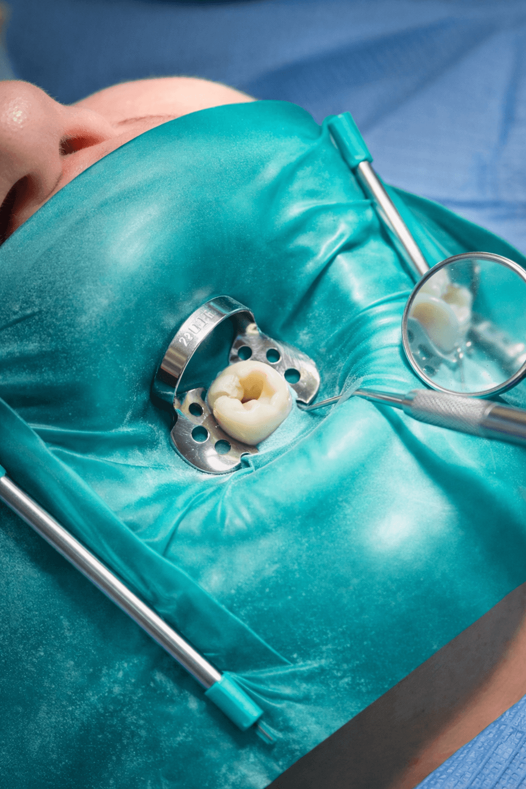 International Standard Rubber Dam