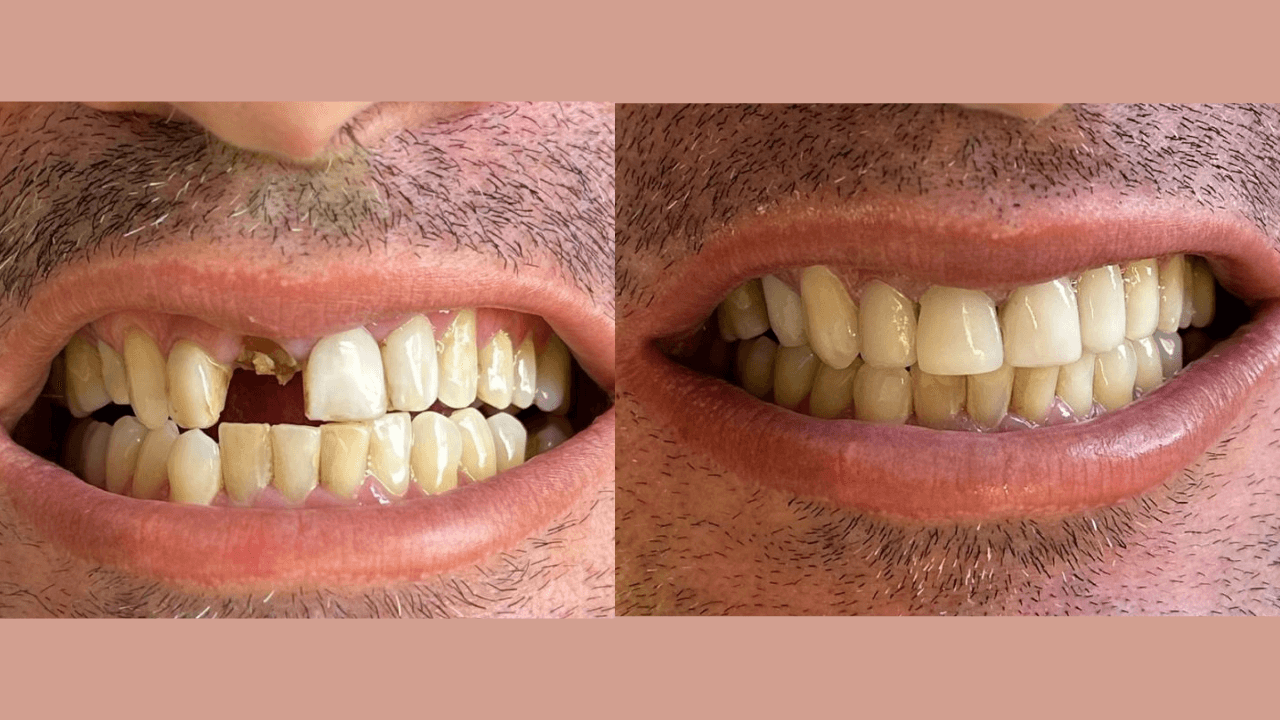 Dental transformation